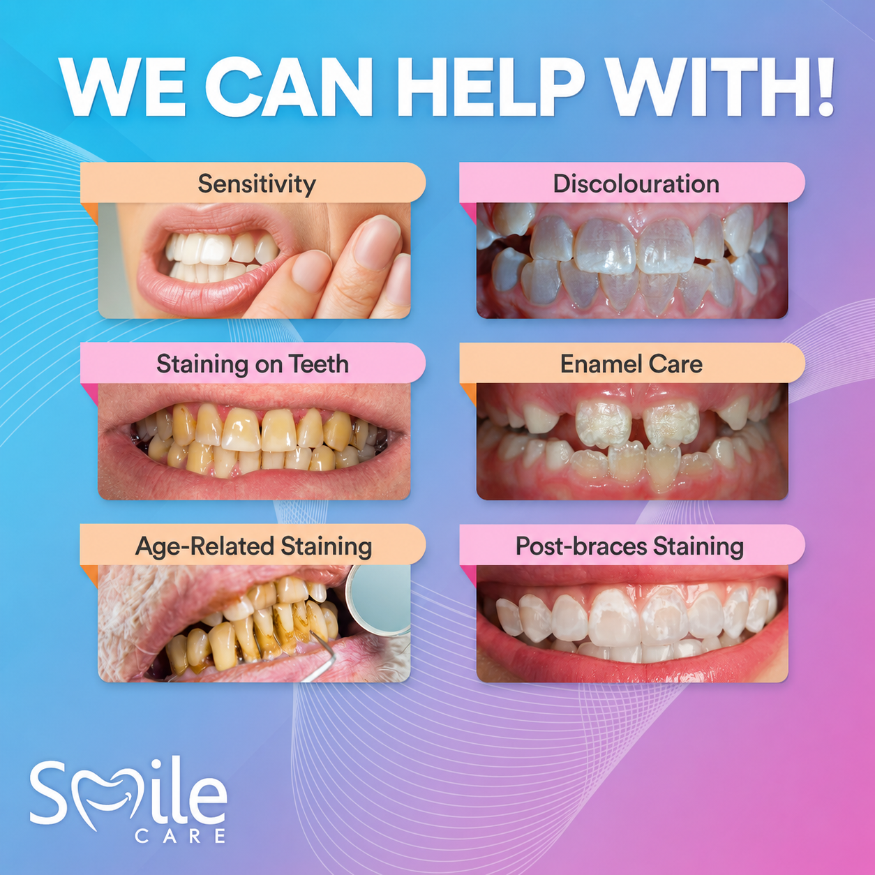 Advanced PAP+ Teeth Whitening Kit